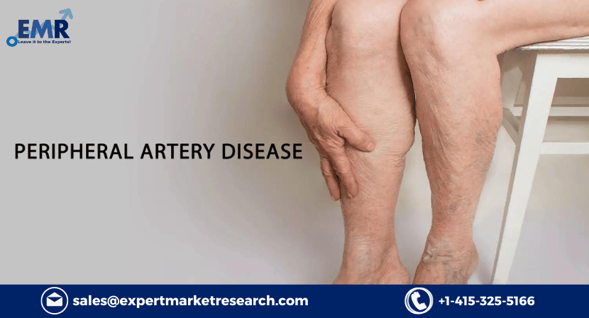 Global Peripheral Artery Disease Market Analysis, Share, Size, Growth, Trends, Report and Forecast Period Of 2023-2028