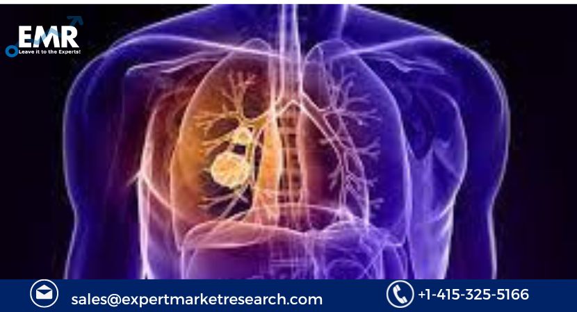Thoracic Surgery Market to be driven by increased demand and technological innovation in the Forecast Period of 2023-2031